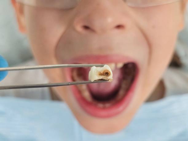 Best Emergency Orthodontic Repairs in Commerce, OK
